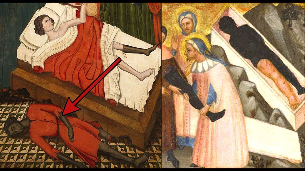 Transplant of the Moor's Leg : Ancient Grafting and Advance Surgical Procedures